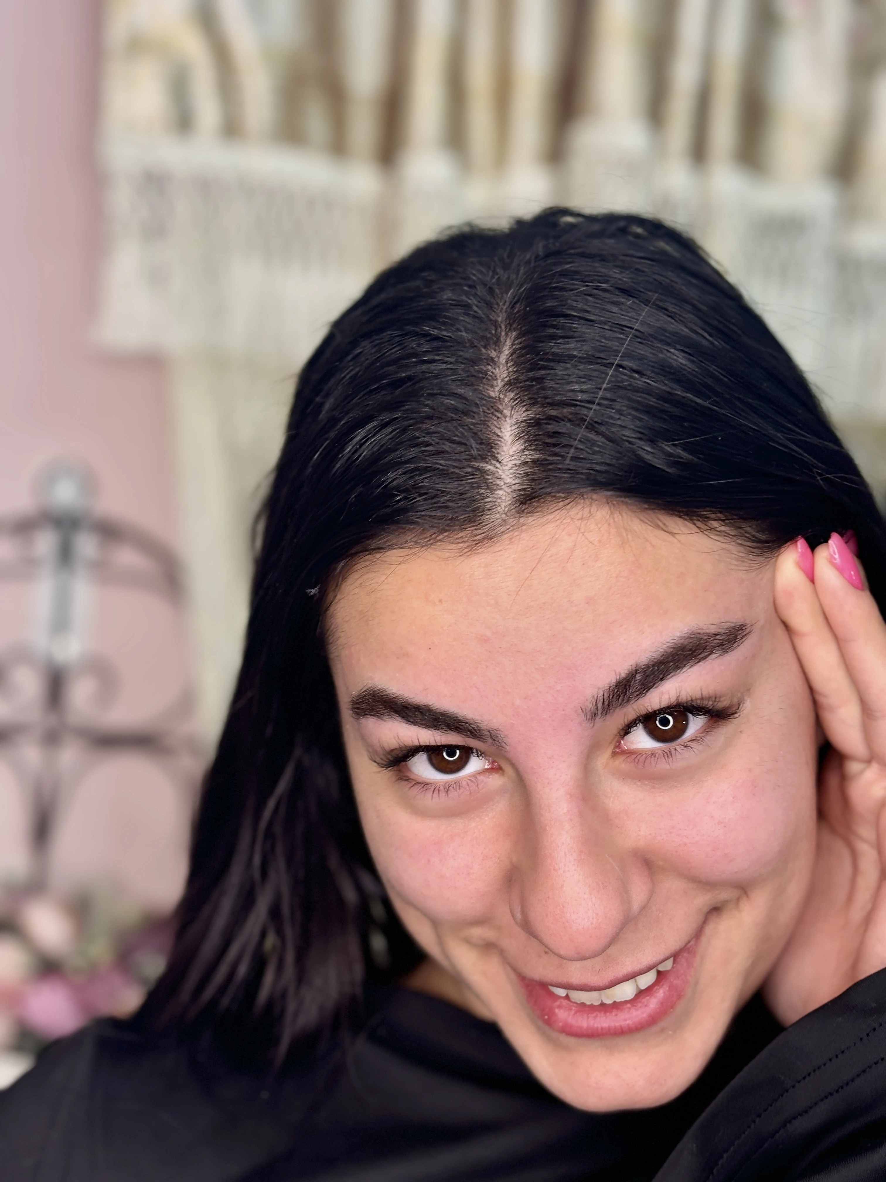 טיפול הרמת גבות לשני המהממת — תוצאות מקצועיות